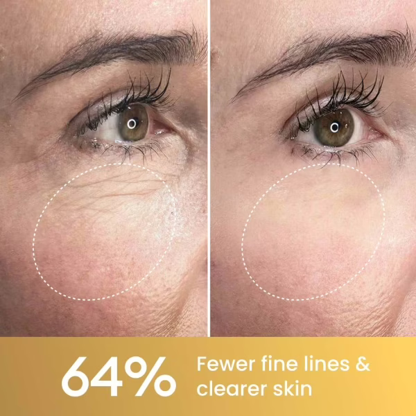GloraMD Renewal - supporting image